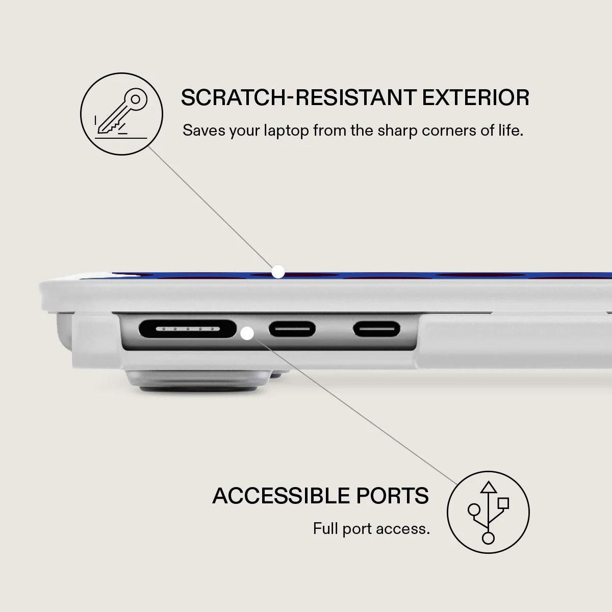 On Pause - Macbook Case - Image 9