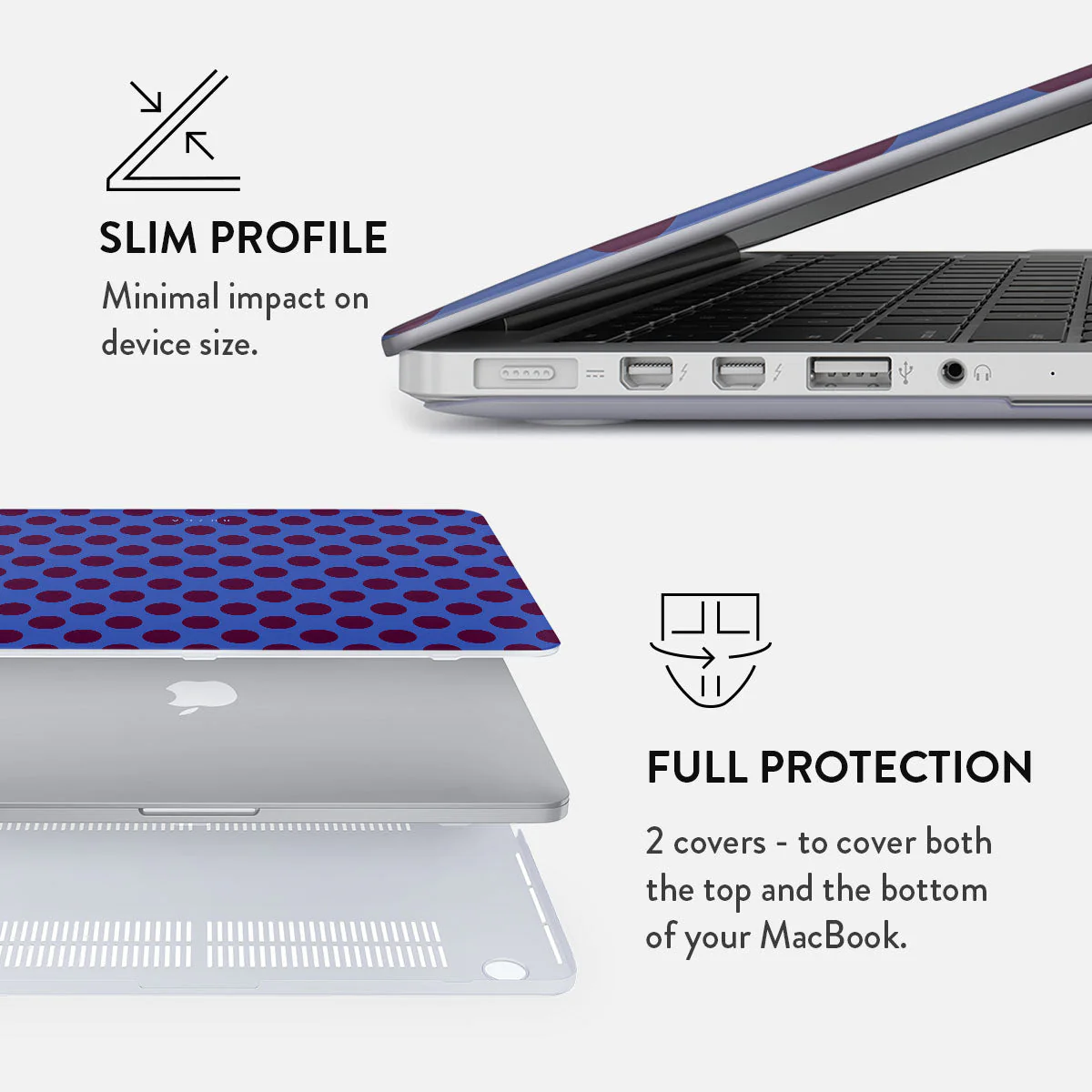 On Pause - Macbook Case - Image 17