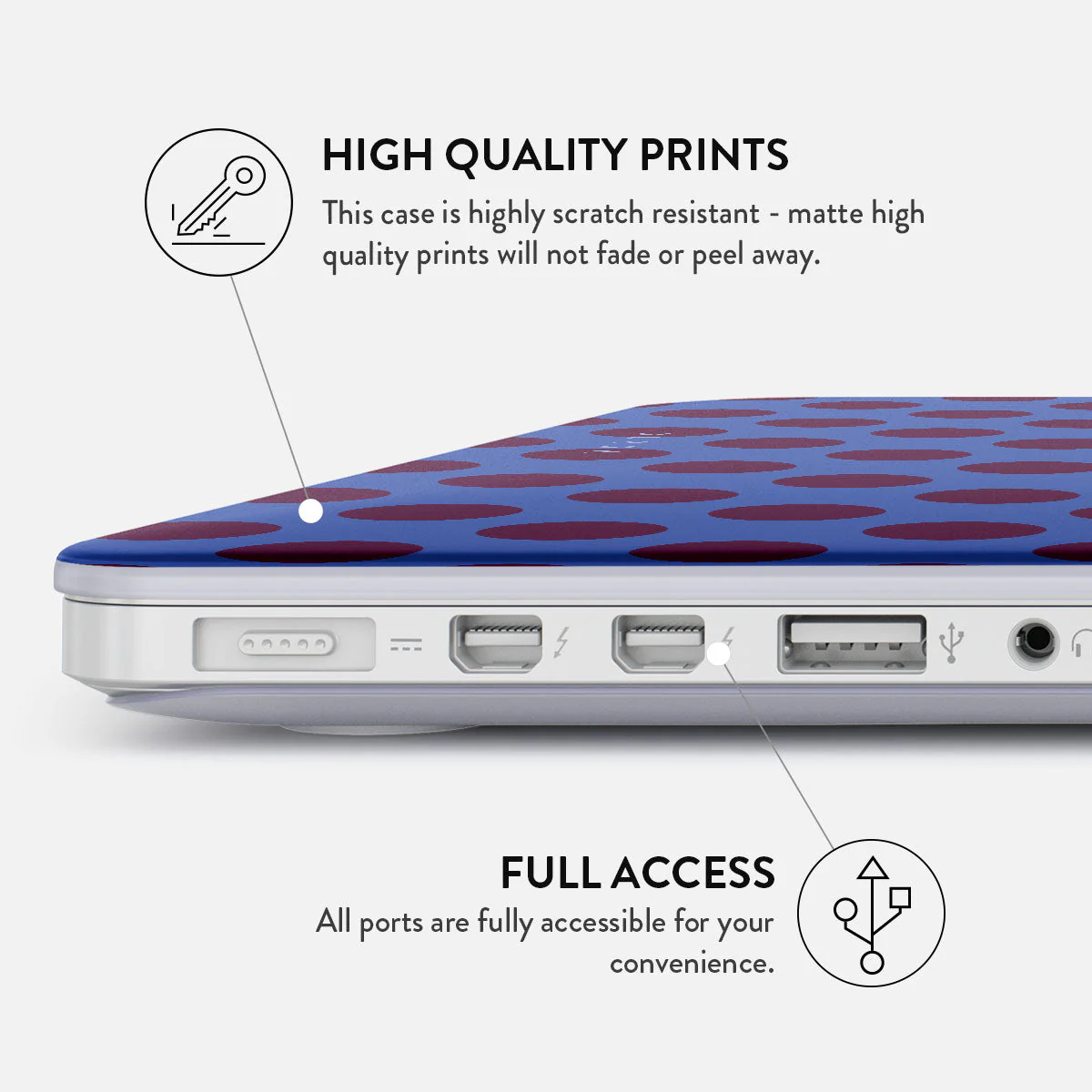 On Pause - Macbook Case - Image 19